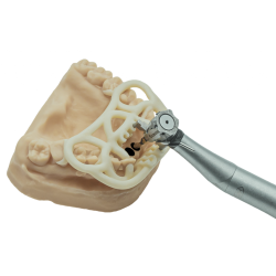 Chirurgie guidée TOV Implant x 2INGIS