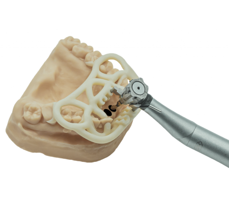 Guided Surgery TOV Implant x 2INGIS