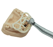 Guided Surgery TOV Implant x 2INGIS