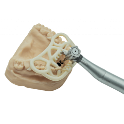 Guided Surgery TOV Implant x 2INGIS