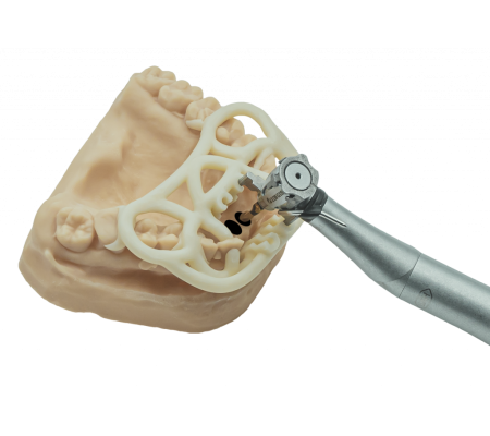 Chirurgie guidée TOV Implant x 2INGIS